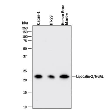 Detection of Human Lipocalin-2/NGAL antibody by Western Blot.