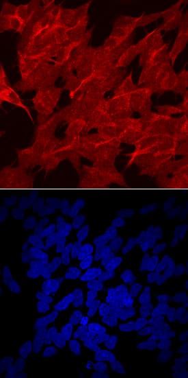 Lipoprotein Lipase/LPL antibody in SH-SY5Y Human Cell Line by Immunocytochemistry (ICC).