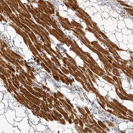 Lipoprotein Lipase/LPL antibody in Human Heart by Immunohistochemistry (IHC-P).