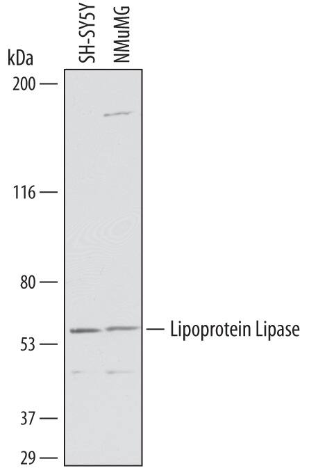 Detection of Human and Mouse Lipoprotein Lipase/LPL antibody by Western Blot.