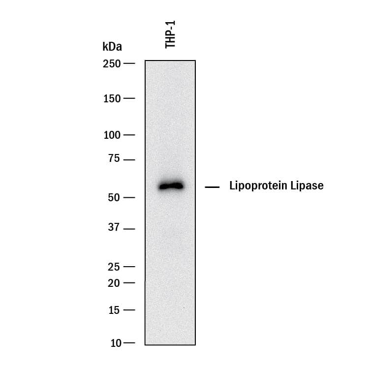 Detection of Human Lipoprotein Lipase/LPL antibody by Western Blot.