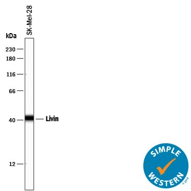 Detection of Human Livin antibody by Simple WesternTM.