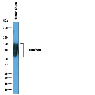 Detection of Human Lumican antibody by Western Blot.