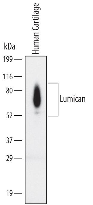 Detection of Human Lumican antibody by Western Blot.