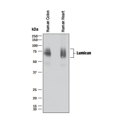 Detection of Human Lumican antibody by Western Blot.