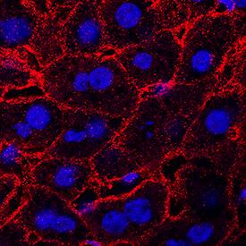 Lymphotoxin  betaR/TNFRSF3 antibody in Mouse Liver by Immunohistochemistry (IHC-Fr).