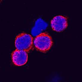 Lyp antibody in Human PBMCs by Immunocytochemistry (ICC).