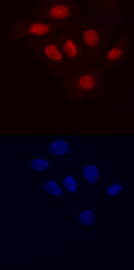 Lysine (K)-specific Demethylase 5B/KDM5B antibody in BT-20 Human Cell Line by Immunocytochemistry (ICC).
