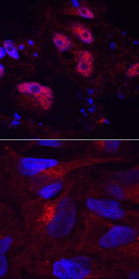 Lysine (K)-specific Demethylase 6B/KDM6B antibody in BG01V Human Stem Cells by Immunocytochemistry (ICC).