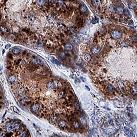 Lysosomal a-Glucosidase antibody in Human Kidney by Immunohistochemistry (IHC-P).