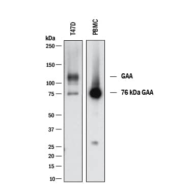 Detection of Human Lysosomal a-Glucosidase antibody by Western Blot.