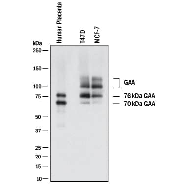 Detection of Human Lysosomal a-Glucosidase antibody by Western Blot.