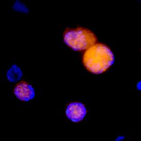 M-CSF R/CD115 antibody in Mouse Splenocytes by Immunocytochemistry (ICC).