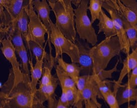 M-Cadherin/Cadherin-15 antibody in C2C12 Mouse Cell Line by Immunocytochemistry (ICC).