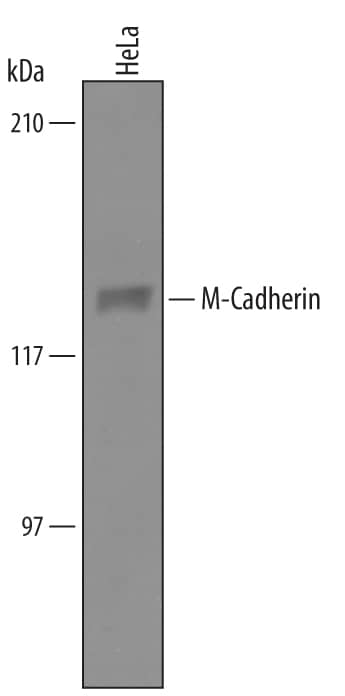 Detection of Human M-Cadherin/Cadherin-15 antibody by Western Blot.