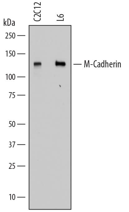 Detection of Mouse and Rat M-Cadherin/Cadherin-15 antibody by Western Blot.