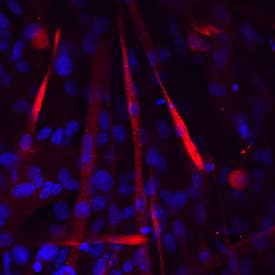 M-Cadherin/Cadherin-15 antibody in C2C12 Mouse Cell Line by Immunocytochemistry (ICC).