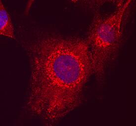 MAGI2 antibody in U-87 MG Human Cell Line by Immunocytochemistry (ICC).
