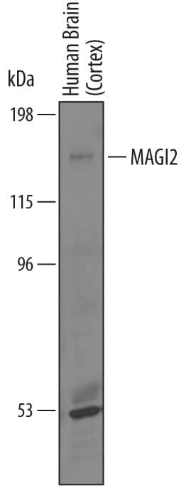 Detection of Human MAGI2 antibody by Western Blot.