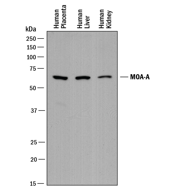 Detection of Human MAO-A antibody by Western Blot.