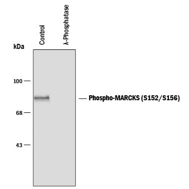 Detection of Phospho-MARCKS (S152/S156) antibody by Western Blot.