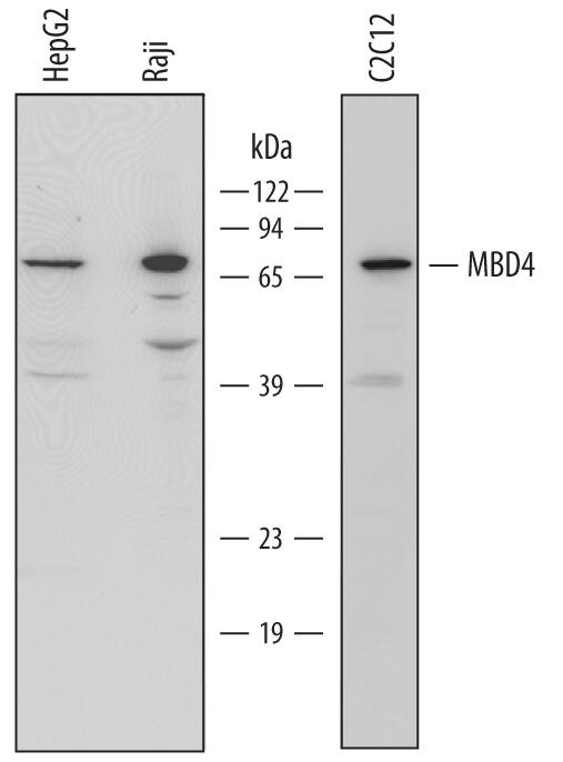 Detection of Human and Mouse MBD4 antibody by Western Blot.