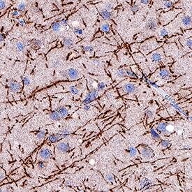 MBP antibody in Human Brain by Immunohistochemistry (IHC-P).