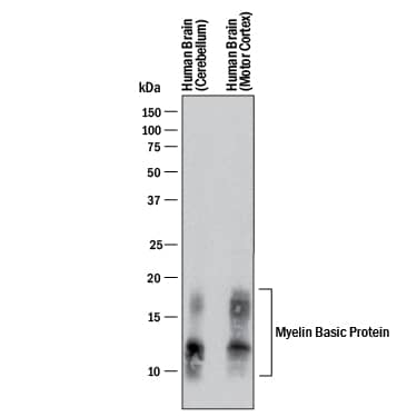 Detection of Human MBP antibody by Western Blot.