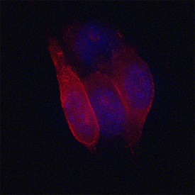 MCAM/CD146 antibody in B16-F1 Mouse Cell Line by Immunocytochemistry (ICC).