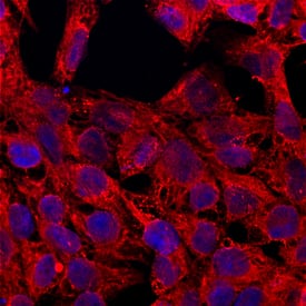 MCAM/CD146 antibody in BG01V Human Embryonic Stem Cells by Immunocytochemistry (ICC).