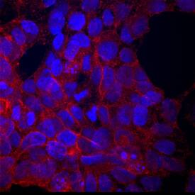 MCAM/CD146 antibody in BG01V Human Embryonic Stem Cells by Immunocytochemistry (ICC).