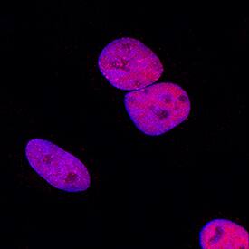 MCM7 antibody in HeLa Human Cell Line by Immunocytochemistry (ICC).