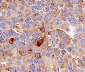 MDL-1/CLEC5A antibody in Human Joint by Immunohistochemistry (IHC-P).