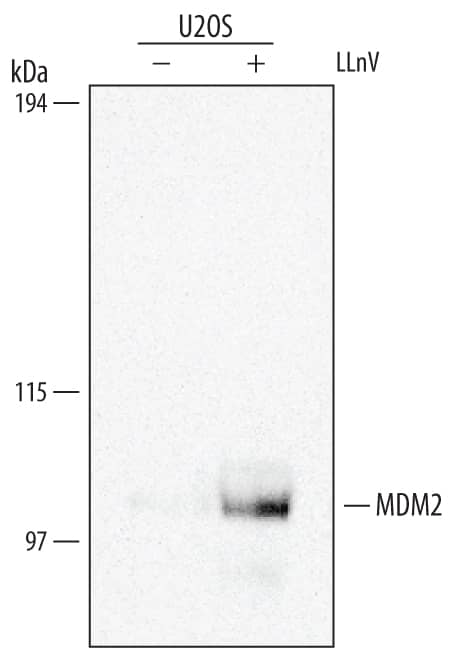 Immunoprecipitation of Human MDM2.