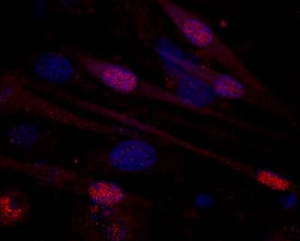 MEF2C antibody in C2C12 Mouse Cell Line by Immunocytochemistry (ICC).