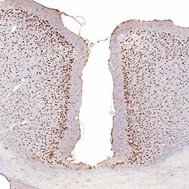 MEF2C antibody in Human Brain by Immunohistochemistry (IHC-P).