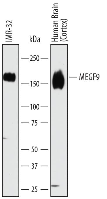 Detection of Human MEGF9 antibody by Western Blot.