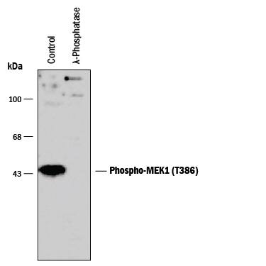 Detection of Phospho-MEK1 (T386) antibody by Western Blot