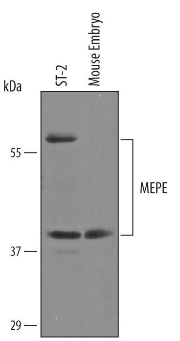 Detection of Mouse MEPE/OF45 antibody by Western Blot.