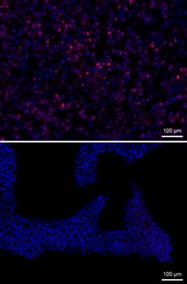 Human MESP1 antibody in H1 Human Embryonic Stem Cells by Immunocytochemistry (ICC).
