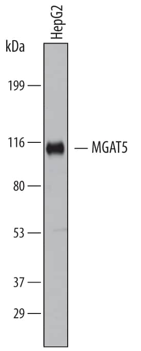 Detection of Human N-Acetylglucosaminyltransferase V/MGAT5 antibody by Western Blot.