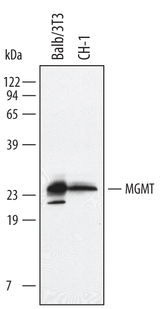 Detection of Mouse MGMT antibody by Western Blot.