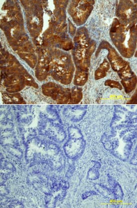 MICA antibody in Human Colon by Immunohistochemistry (IHC-P).
