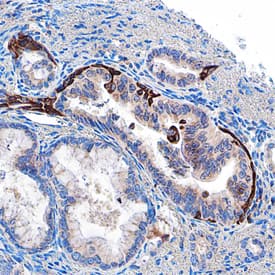 MICA/B in Human Pancreas. MICA/B antibody in Human Pancreas by Immunohistochemistry (IHC-P).