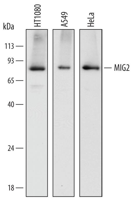 Detection of Human MIG2 antibody by Western Blot.