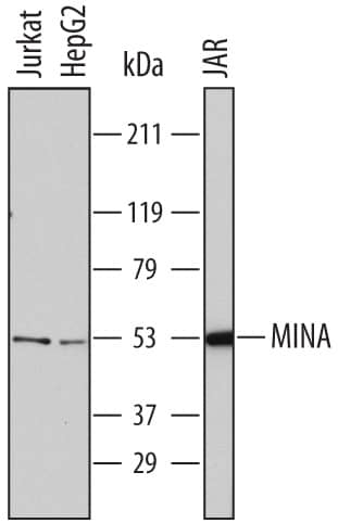 Detection of Human MINA antibody by Western Blot.