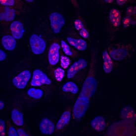 Ki67/MKI67 antibody in A549 Human Cell Line by Immunocytochemistry (ICC).