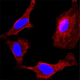 MKK4 antibody in HeLa Human Cell Line by Immunocytochemistry (ICC).