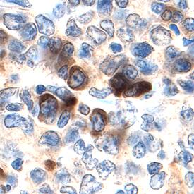 MKK7 antibody in Human Tonsil by Immunohistochemistry (IHC-P).