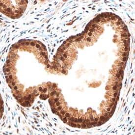 MKP-1 antibody in Human Prostate by Immunohistochemistry (IHC-P).